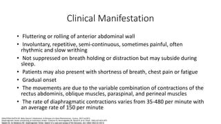 belly dancer dyskinesia|diaphragm flutter when lying down.